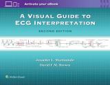 A Visual Guide To Ecg Interpretation